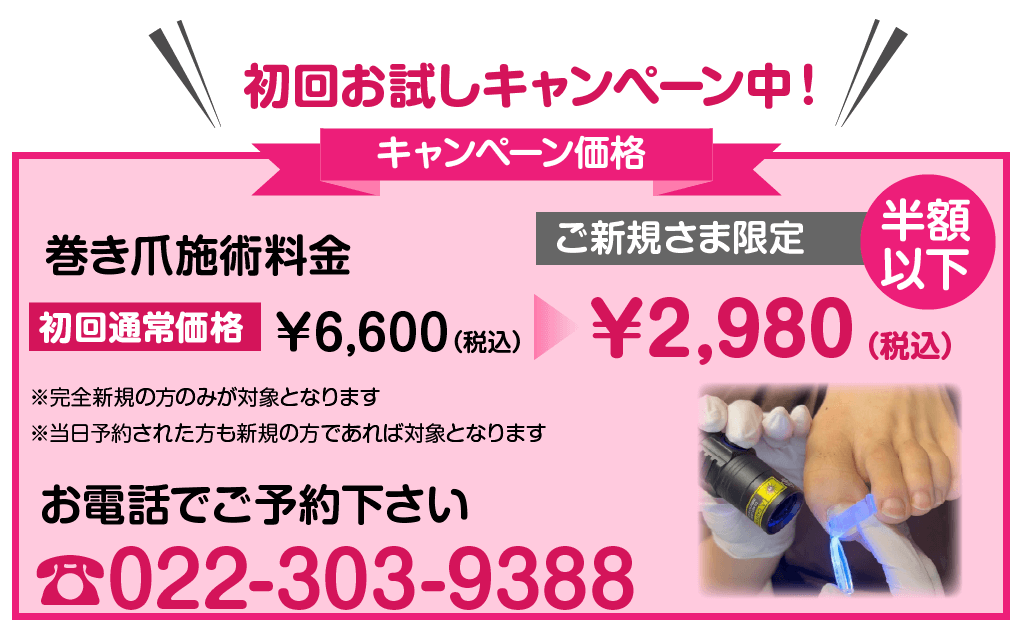 巻き爪初回2980円